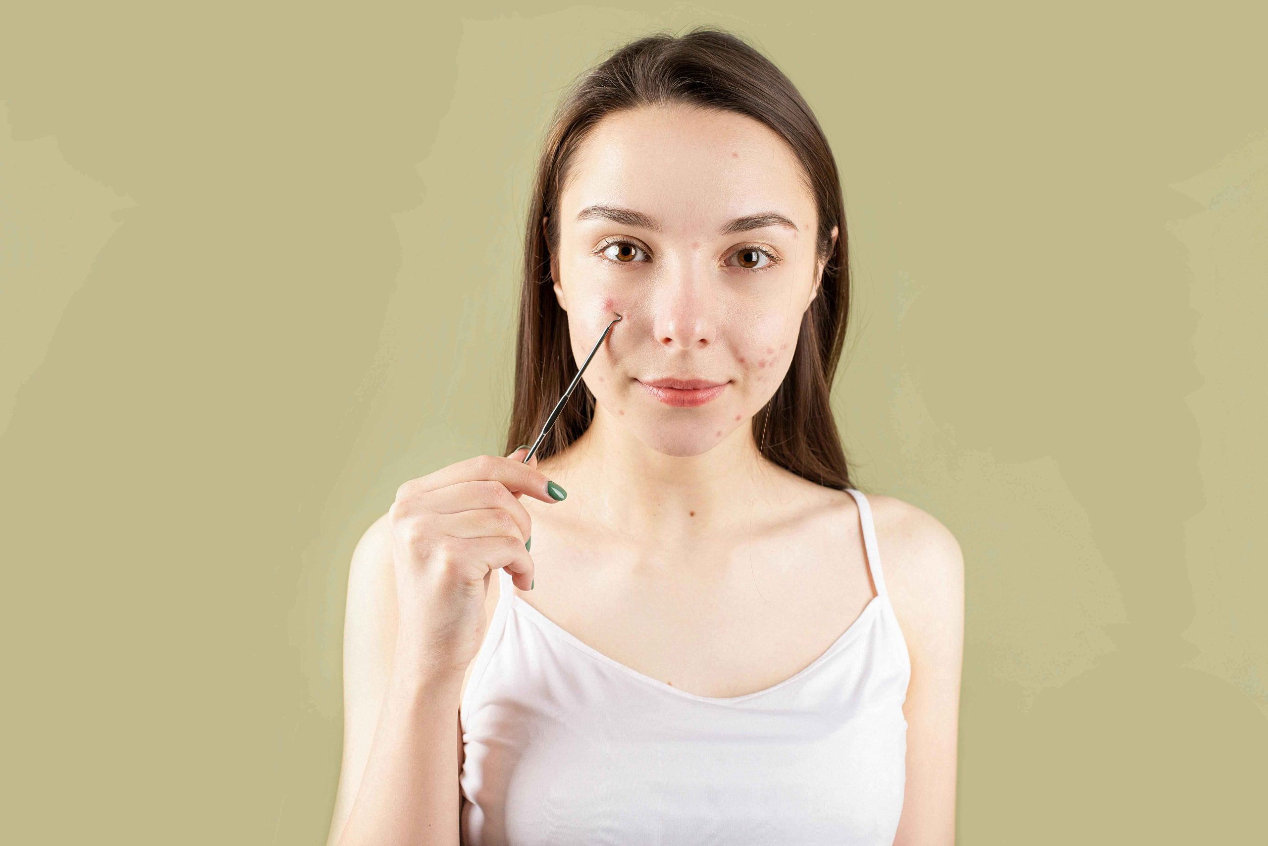 How to prevent pimples